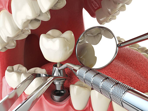 Best Urgent Dental Care in Combe, LA