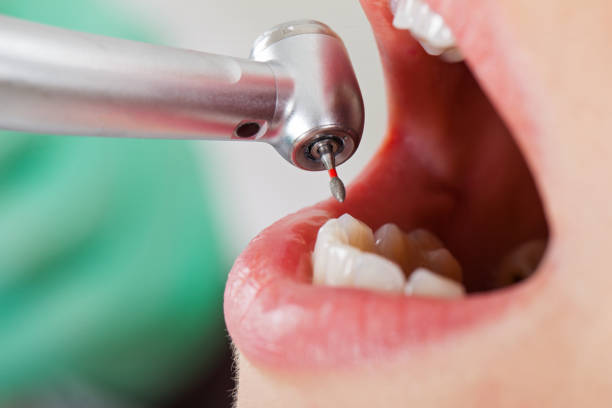Best Same-Day Emergency Dentist in Combe, LA